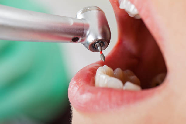 Best Emergency Gum Treatment in Lmyra, PA